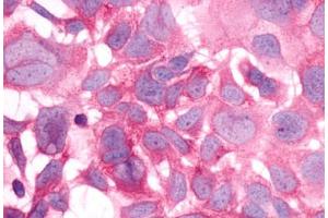 Image no. 2 for anti-Histamine Receptor H3 (HRH3) (Cytoplasmic Domain) antibody (ABIN1048962) (HRH3 anticorps  (Cytoplasmic Domain))