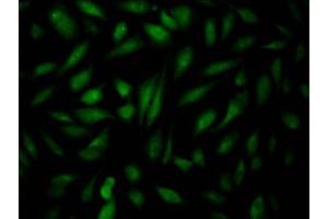 Immunofluorescence staining of Hela Cells with ABIN7127543 at 1:50, counter-stained with DAPI. (Recombinant EPAS1 anticorps)