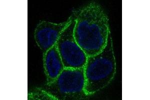 Immunofluorescent analysis of A431 cells, using EGFR Antibody . (Recombinant EGFR anticorps)