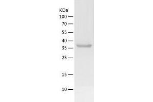 Western Blotting (WB) image for Ring Finger Protein 34 (RNF34) (AA 1-373) protein (His tag) (ABIN7124915) (RNF34 Protein (AA 1-373) (His tag))