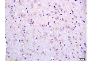 Formalin-fixed and paraffin embedded rat brain labeled with Anti-BCAT2/BCAM Polyclonal Antibody, Unconjugated (ABIN718511) at 1:200 followed by conjugation to the secondary antibody and DAB staining. (BCAT2 anticorps  (AA 101-200))