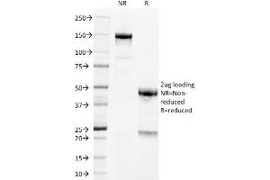 SDS-PAGE Analysis Purified PLAP Mouse Monoclonal Antibody (GM022). (PLAP anticorps)