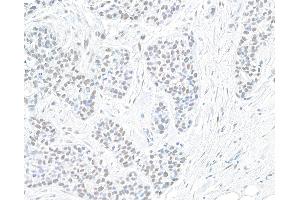Immunohistochemistry (IHC) image for anti-Polybromo 1 (PBRM1) (AA 1-293) antibody (ABIN7454032)