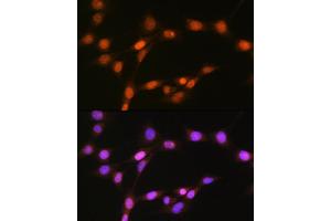 Immunofluorescence analysis of NIH-3T3 cells using HD Rabbit mAb (ABIN7267714) at dilution of 1:100 (40x lens).