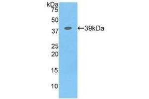 Detection of Recombinant CSF2Rb, Human using Polyclonal Antibody to Colony Stimulating Factor 2 Receptor Beta (CSF2Rb) (CD131 anticorps  (AA 133-233))