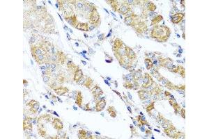 Immunohistochemistry of paraffin-embedded Human stomach using DARS2 Polyclonal Antibody at dilution of 1:100 (40x lens).