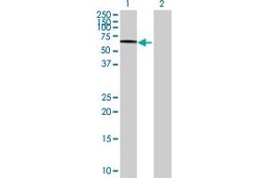 Western Blot analysis of SCARB2 expression in transfected 293T cell line by SCARB2 MaxPab polyclonal antibody. (SCARB2 anticorps  (AA 1-478))