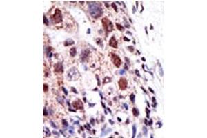 Image no. 2 for anti-Ubiquitin-Conjugating Enzyme E2S (UBE2S) (N-Term) antibody (ABIN357497) (UBE2S anticorps  (N-Term))