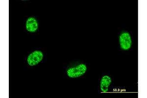 Immunofluorescence of purified MaxPab antibody to SEPT12 on HeLa cell.