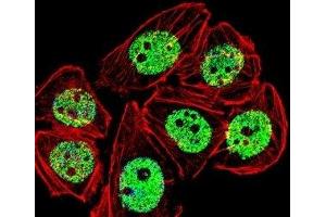 Fluorescent confocal image of A549 cells stained with FOXG1 antibody.