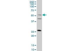 FLJ36180 monoclonal antibody (M01), clone 4F8 Western Blot analysis of FLJ36180 expression in A-431 . (TRIML1 anticorps  (AA 369-468))
