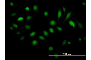 Immunofluorescence of purified MaxPab antibody to BAG5 on HeLa cell.