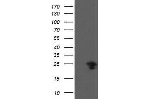 Western Blotting (WB) image for anti-Prefoldin Subunit 3 (PFDN3) antibody (ABIN1501702) (VBP1 anticorps)