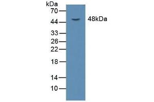 Detection of LOX1 in Mouse Liver Tissue using Polyclonal Antibody to Lectin Like Oxidized Low Density Lipoprotein Receptor 1 (LOX1) (OLR1 anticorps  (AA 51-314))