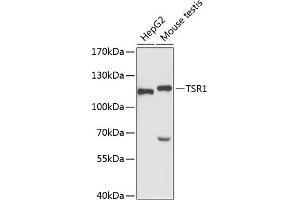 Western blot analysis of extracts of various cell lines, using TSR1 antibody (ABIN6132976, ABIN6149654, ABIN6149655 and ABIN6220781) at 1:3000 dilution.