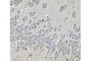 Immunohistochemistry of paraffin-embedded Mouse brain using PRKAB2 Polyclonal Antibody at dilution of 1:100 (40x lens).