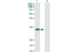 Western Blot analysis of WISP2 expression in transfected 293T cell line by WISP2 monoclonal antibody (M09), clone 3D10. (WISP2 anticorps  (AA 24-250))