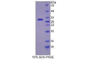 SDS-PAGE analysis of Mouse Docking Protein 3 Protein. (DOK3 Protéine)