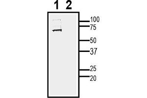 Western blot analysis of human  neuroblastoma cell lysate:1. (NMNAT2 anticorps  (Intracellular))