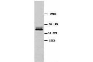 Image no. 1 for anti-Enolase 2 (Gamma, Neuronal) (ENO2) (C-Term) antibody (ABIN1493043) (ENO2/NSE anticorps  (C-Term))