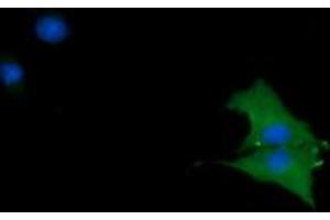 Image no. 3 for anti-Cancer/testis Antigen 1B (CTAG1B) antibody (ABIN1499893) (CTAG1B anticorps)