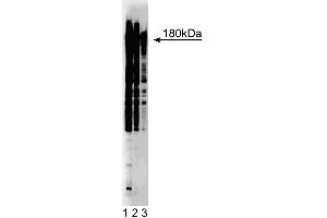 Western blot analysis of phosphotyrosine on A431 cell lysate. (Phosphotyrosine anticorps)