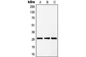 Western blot analysis of PTTG1/2/3 expression in HepG2 (A), Jurkat (B), NIH3T3 (C) whole cell lysates. (PTTG1/2/3 anticorps  (Center))