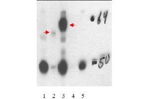 Image no. 1 for anti-Thyroid Hormone Receptor, beta (THRB) (Isoform 1), (Isoform beta-1), (N-Term) antibody (ABIN401449) (THRB anticorps  (Isoform 1, Isoform beta-1, N-Term))
