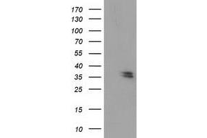 Western Blotting (WB) image for anti-Nudix (Nucleoside Diphosphate Linked Moiety X)-Type Motif 6 (NUDT6) antibody (ABIN1499873) (NUDT6 anticorps)