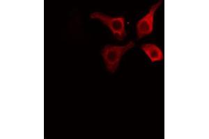 ABIN6267595 staining HuvEc cells by IF/ICC.