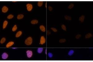 Immunofluorescence analysis of U-2 OS cells using Acetyl-Histone H3-K9/K14/K18/K23/K27 Polyclonal Antibody at dilution of 1:100.