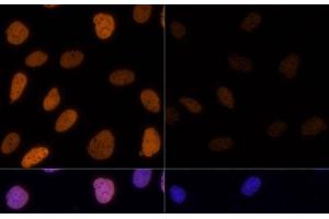 Immunofluorescence analysis of U-2 OS cells using Acetyl-Histone H3-K9/K14/K18/K23/K27 Polyclonal Antibody at dilution of 1:100. (Histone 3 anticorps  (acLys9, acLys14, acLys18, acLys23, acLys27))