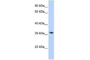 Image no. 1 for anti-Lysophospholipase II (LYPLA2) (N-Term) antibody (ABIN632189)