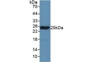 Detection of Recombinant LEP, Mouse using Polyclonal Antibody to Leptin (LEP) (Leptin anticorps  (AA 22-167))