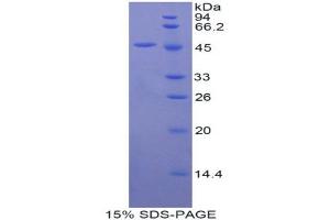 SDS-PAGE (SDS) image for Fibroblast Growth Factor 10 (FGF10) (AA 37-209) protein (His tag,GST tag) (ABIN1877618) (FGF10 Protein (AA 37-209) (His tag,GST tag))