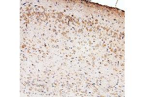 IHC analysis of GLI2 using anti-GLI2 antibody (ABIN6719569).