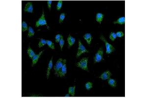 IF analysis of IL2 Receptor beta/p75/IL2RB using anti- IL2 Receptor beta/p75/IL2RB antibody (ABIN7600988).