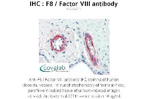 Image no. 2 for anti-Coagulation Factor VIII (F8) antibody (ABIN1723234) (Factor VIII anticorps)