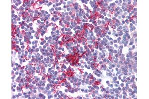 Anti-Estrogen Receptor antibody IHC of human tonsil.