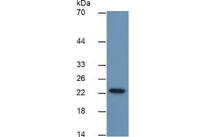 Mouse Capture antibody from the kit in WB with Positive Control: Sample Human MCF7 cell lysate. (GSTP1 Kit ELISA)