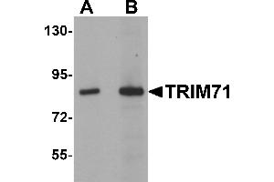 Western Blotting (WB) image for anti-Tripartite Motif Containing 71, E3 Ubiquitin Protein Ligase (TRIM71) (C-Term) antibody (ABIN1030777) (TRIM71 anticorps  (C-Term))