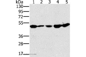 Western blot analysis of 231 and Jurkat cell, mouse liver tissue, 293T and hela cell, using PSMC2 Polyclonal Antibody at dilution of 1:400 (PSMC2 anticorps)