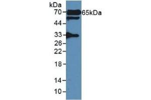 Detection of GAD2 in Rat Serum using Polyclonal Antibody to Glutamate Decarboxylase 2 (GAD2)