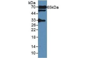 Detection of GAD2 in Rat Serum using Polyclonal Antibody to Glutamate Decarboxylase 2 (GAD2) (GAD65 anticorps  (AA 188-374))