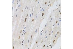 Immunohistochemistry of paraffin-embedded rat heart using KPNA4 Antibody.