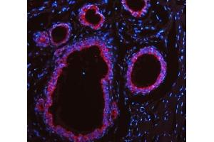 IF analysis of Cytokeratin 19 using anti-Cytokeratin 19 antibody (ABIN3043288).