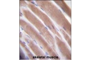 VEGF3 Antibody (N-term) (ABIN655891 and ABIN2845292) immunohistochemistry analysis in formalin fixed and paraffin embedded human skeletal muscle followed by peroxidase conjugation of the secondary antibody and DAB staining.