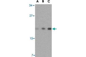 Western blot analysis of TMED10 in mouse brain tissue lysate with TMED10 polyclonal antibody  at (A) 0. (TMED10 anticorps  (Internal Region))