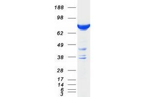 Validation with Western Blot
