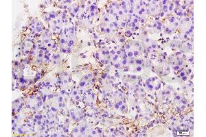 Formalin-fixed and paraffin embedded rat pancreas tissue labeled with Anti-MTUS1 Polyclonal Antibody, Unconjugated  at 1:200 followed by conjugation to the secondary antibody and DAB staining